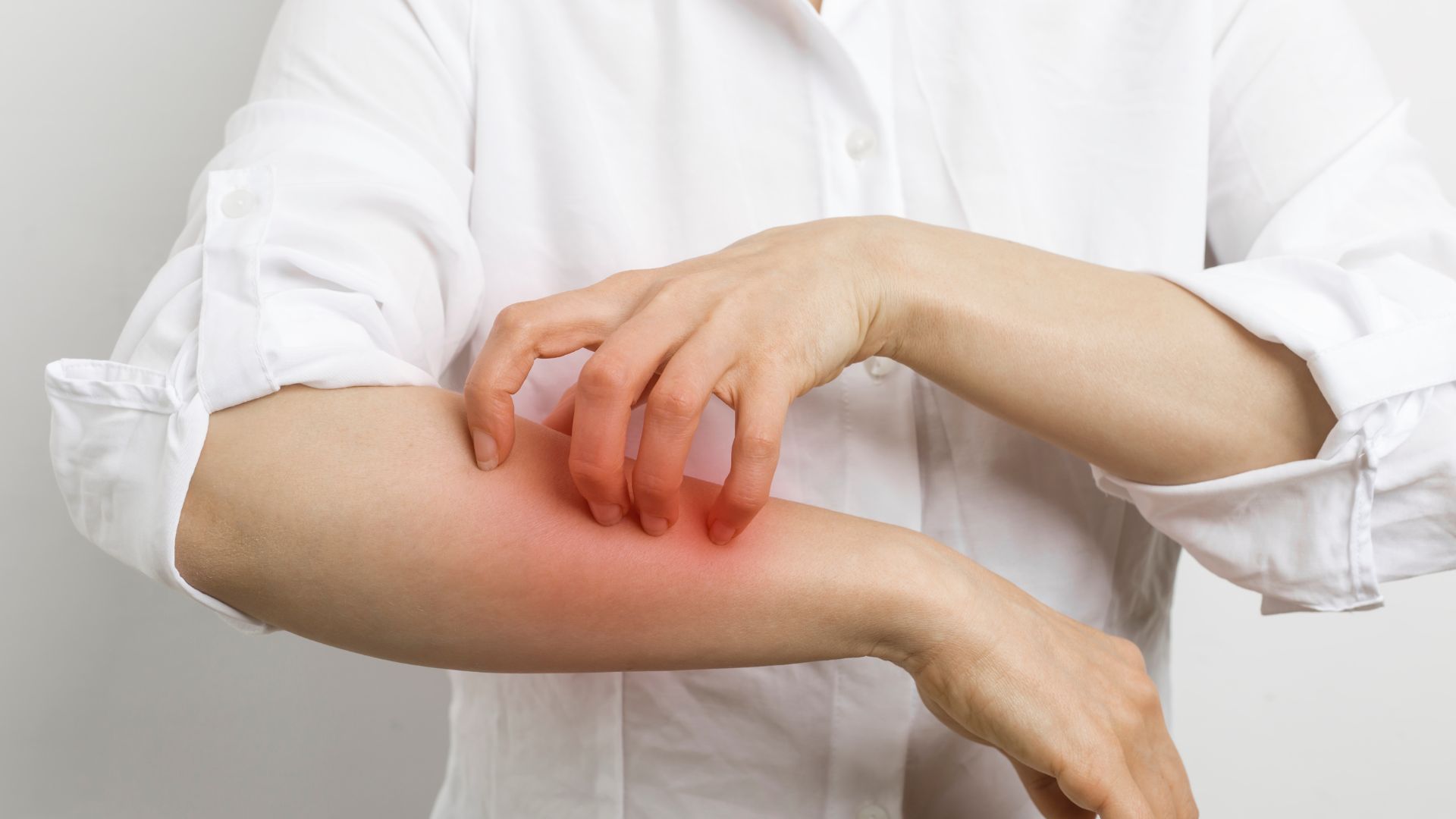 Kenapa sih alergi bisa terjadi?